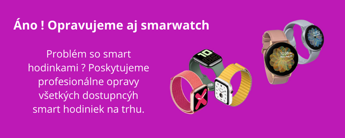 Servis smartwatch